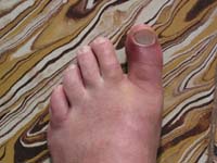dedo_040315_1360