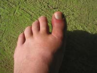 dedo_040316_1424