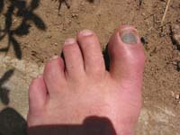 dedo_040322_1595